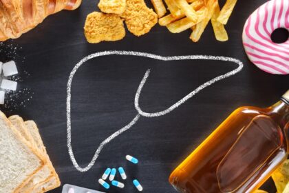 5 alimentos que arruinan tu higado