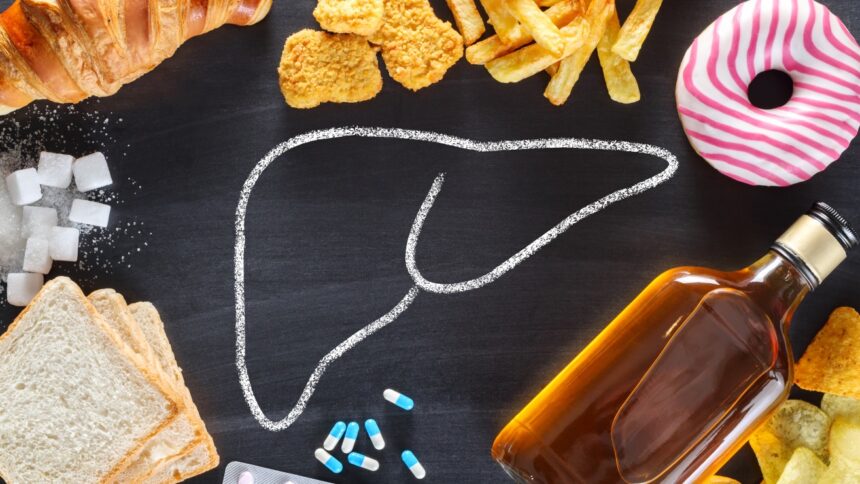 5 alimentos que arruinan tu higado